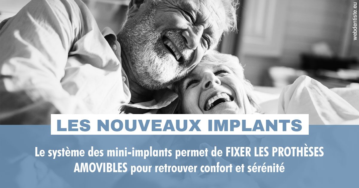 https://dr-galet-francois.chirurgiens-dentistes.fr/Les nouveaux implants 2