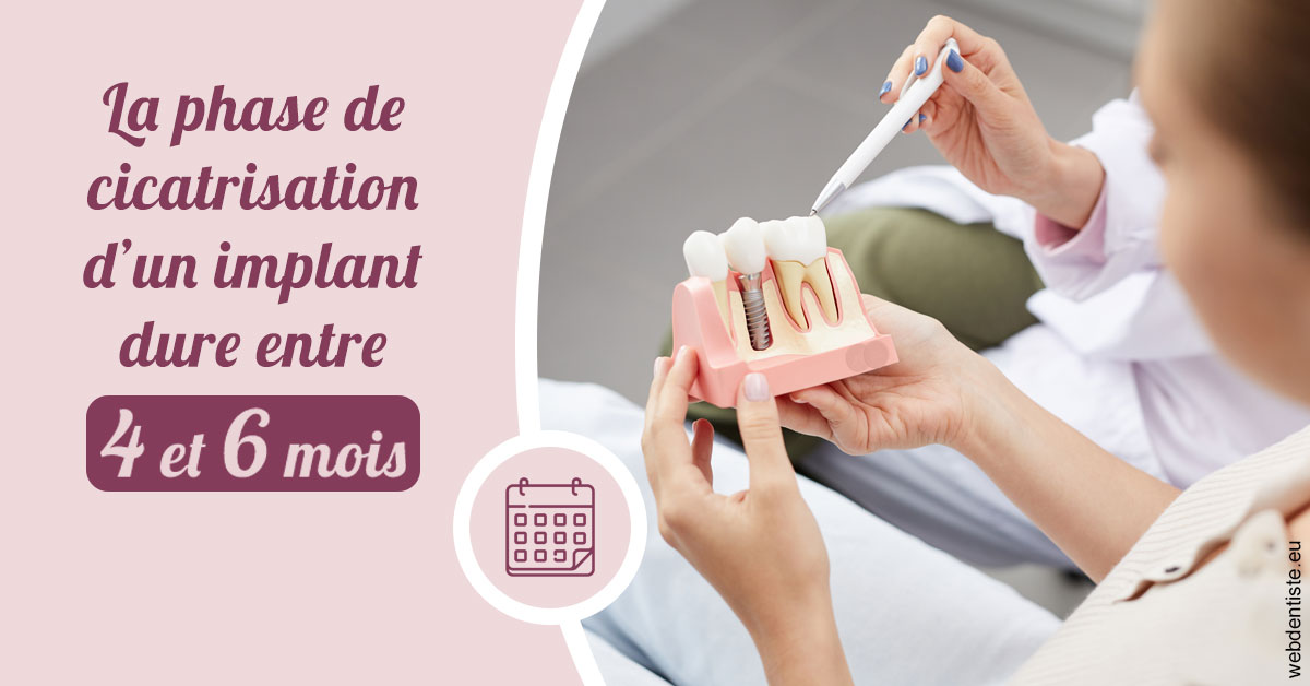 https://dr-galet-francois.chirurgiens-dentistes.fr/Cicatrisation implant 2
