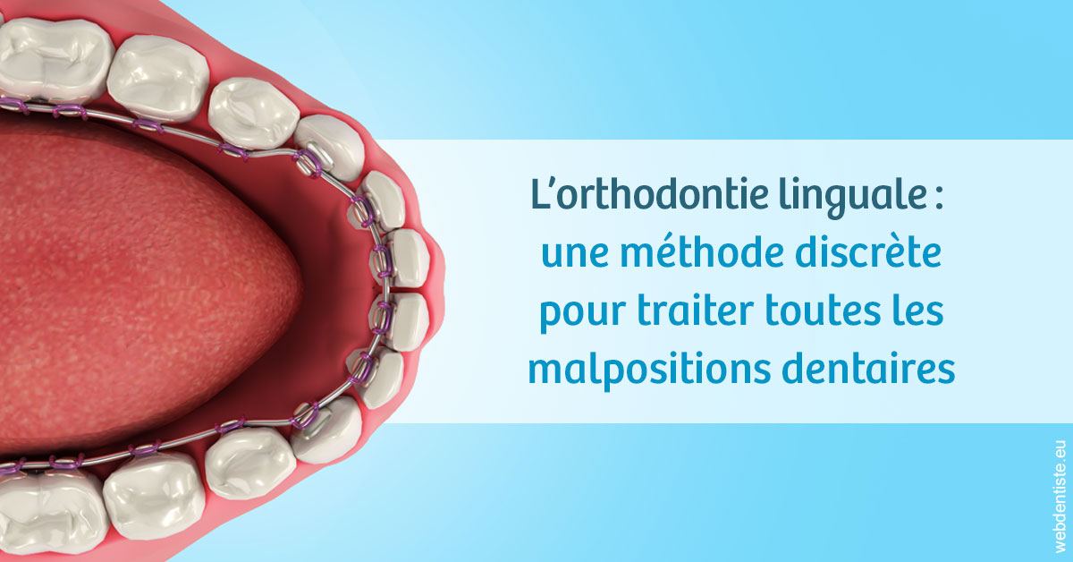 https://dr-galet-francois.chirurgiens-dentistes.fr/L'orthodontie linguale 1