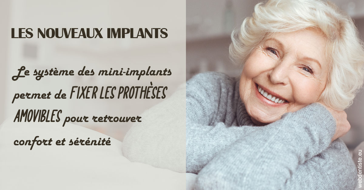 https://dr-galet-francois.chirurgiens-dentistes.fr/Les nouveaux implants 1