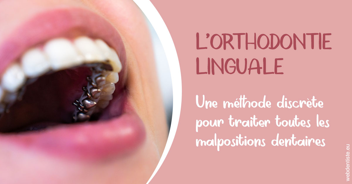 https://dr-galet-francois.chirurgiens-dentistes.fr/L'orthodontie linguale 2