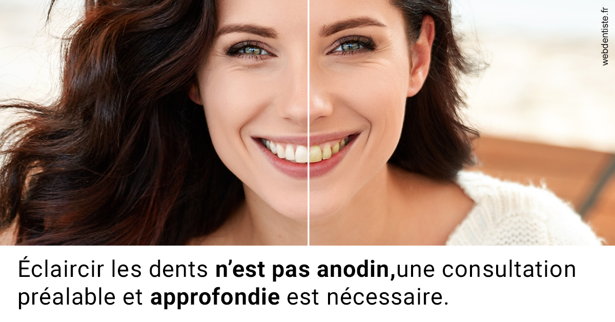 https://dr-galet-francois.chirurgiens-dentistes.fr/Le blanchiment 2