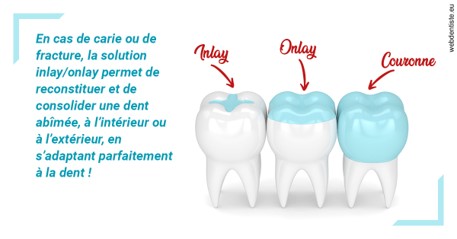 https://dr-galet-francois.chirurgiens-dentistes.fr/L'INLAY ou l'ONLAY