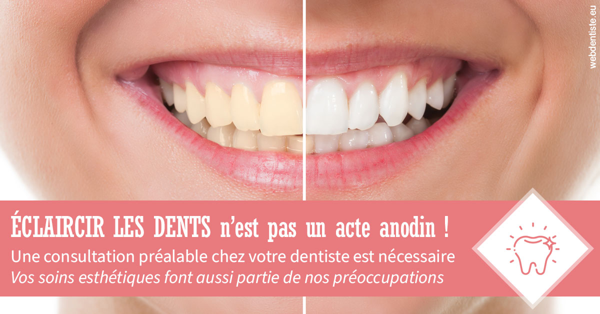 https://dr-galet-francois.chirurgiens-dentistes.fr/Eclaircir les dents 1