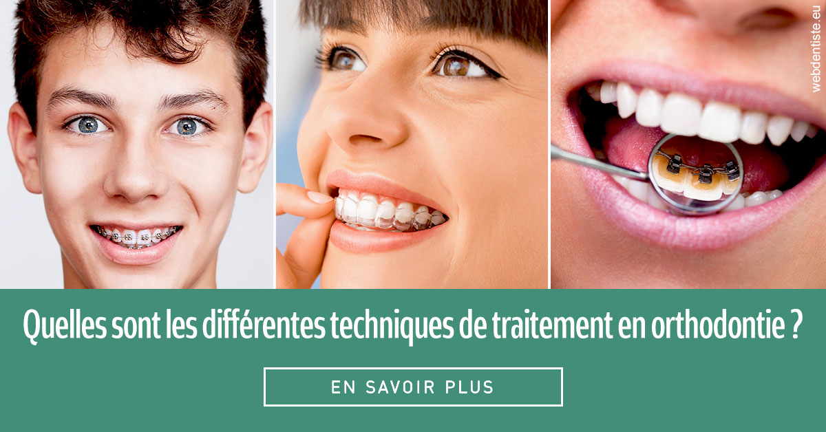 https://dr-galet-francois.chirurgiens-dentistes.fr/Les différentes techniques de traitement 2