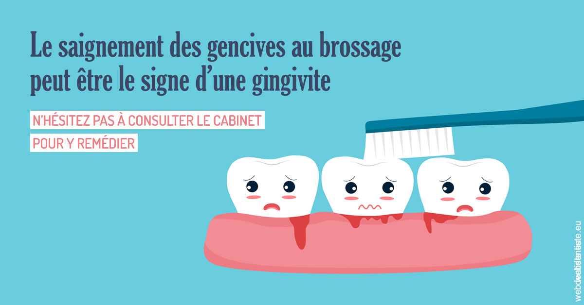 https://dr-galet-francois.chirurgiens-dentistes.fr/Saignement gencives 2
