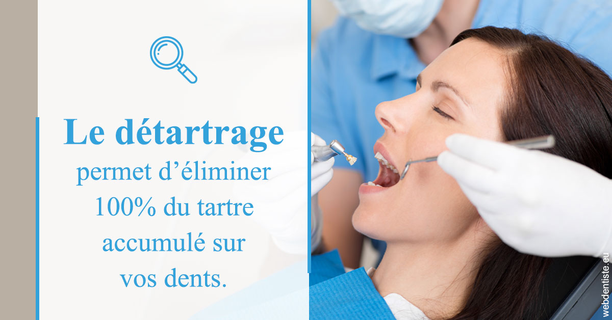 https://dr-galet-francois.chirurgiens-dentistes.fr/En quoi consiste le détartrage