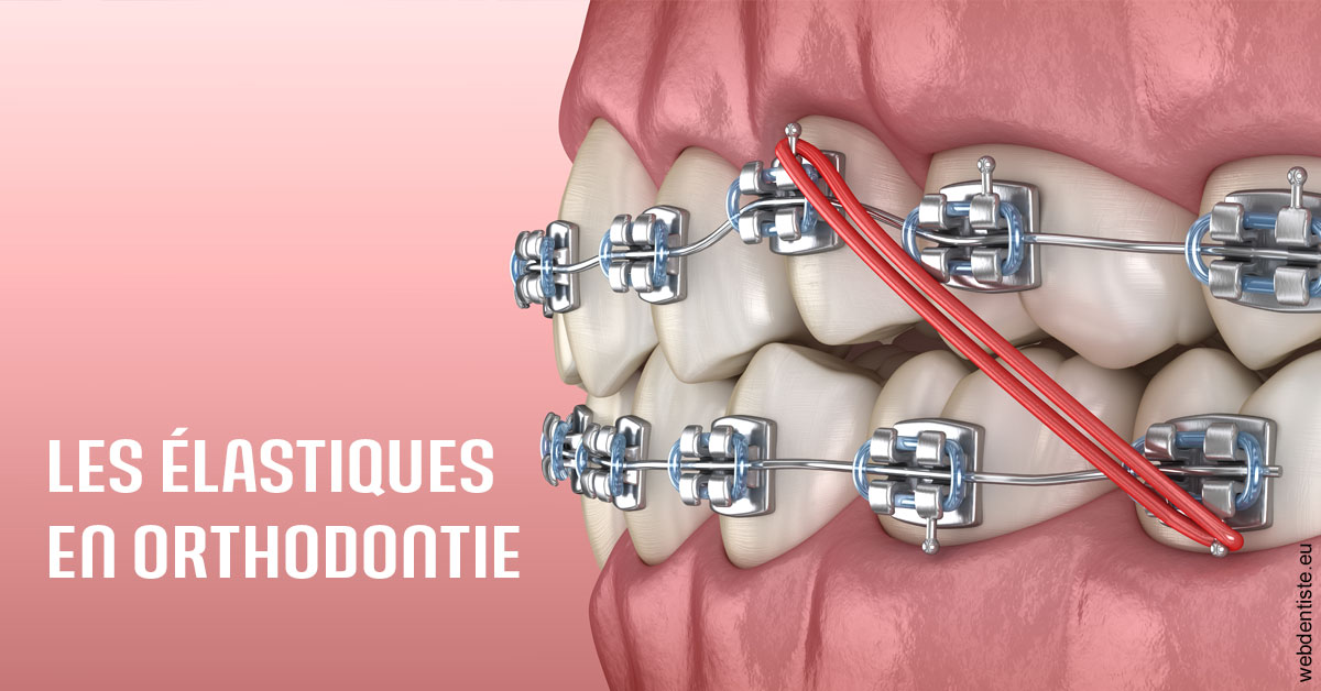 https://dr-galet-francois.chirurgiens-dentistes.fr/Elastiques orthodontie 2