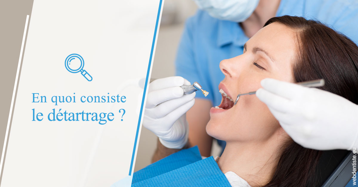 https://dr-galet-francois.chirurgiens-dentistes.fr/En quoi consiste le détartrage