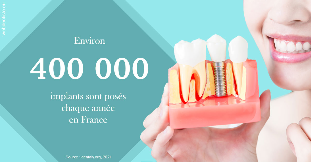https://dr-galet-francois.chirurgiens-dentistes.fr/Pose d'implants en France 2